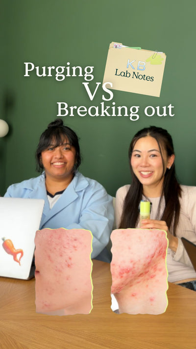 KB lab note: purging vs breaking out 
